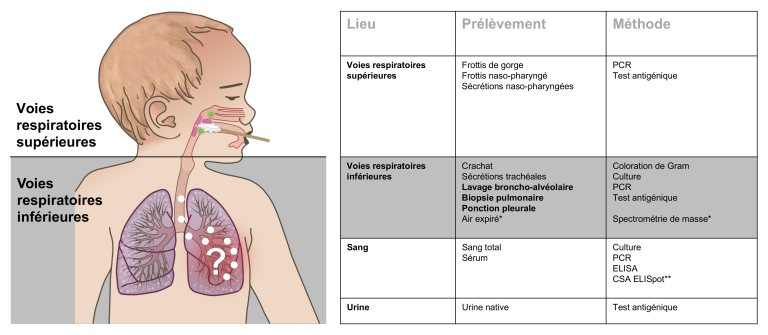 Diagnostic et traitement de la pneumonie pendant l’enfance et l